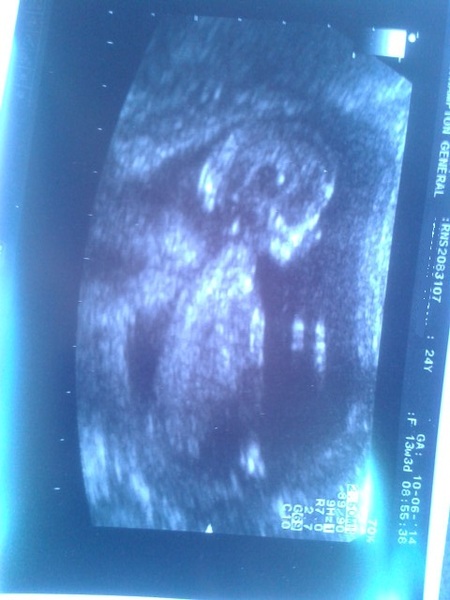 December 2014 Thread #4