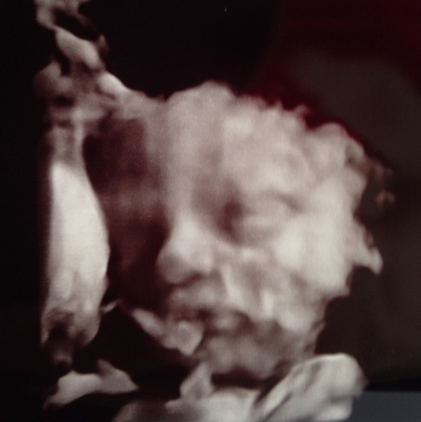 August 2014: Bigger Bumps and Maternity Leave Countdowns