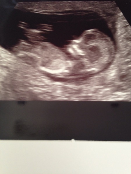 Going Clucking mental? Old birds gather round.....