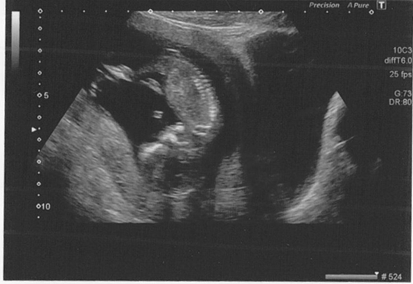 December 2014 Thread #4