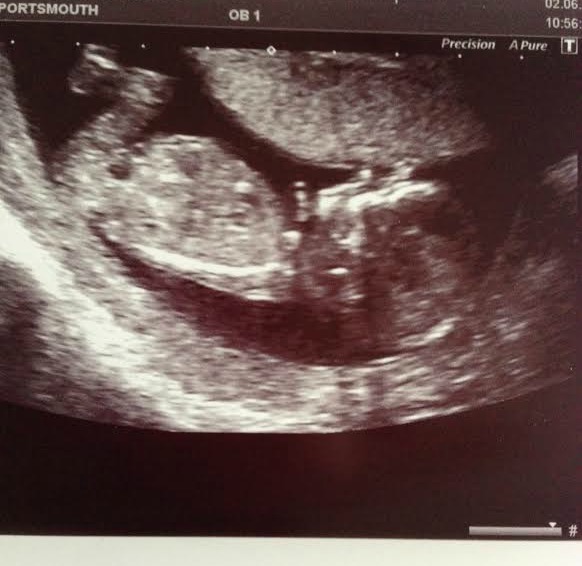 We have fire in our bellies, we're incubating our little Penis Dragons! #3