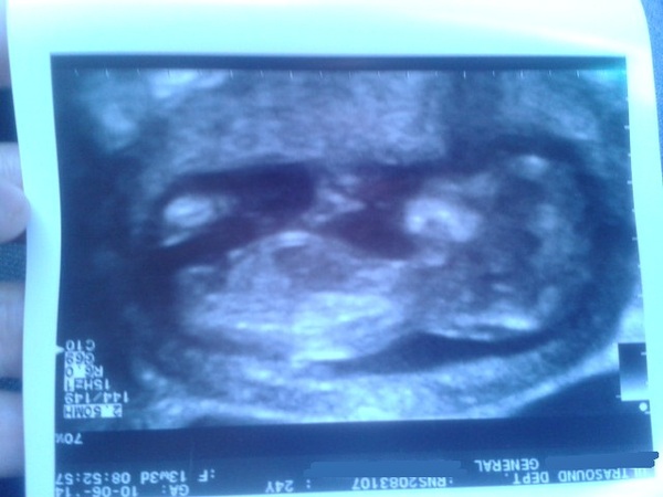 December 2014 Thread #4