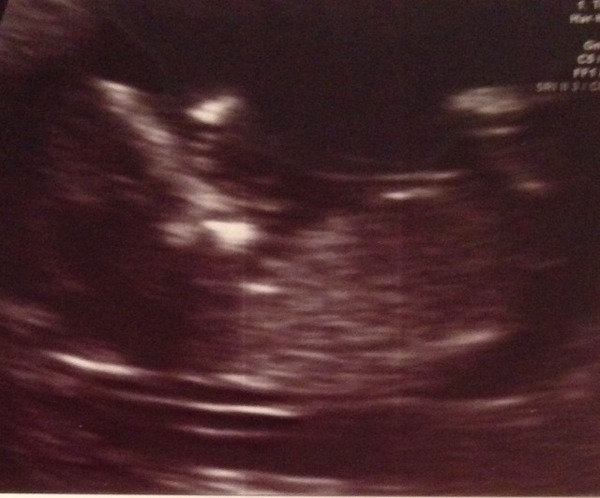 Just Shagging Grads Thread 9 - Roll Up, Roll Up all you graduated Viroids!