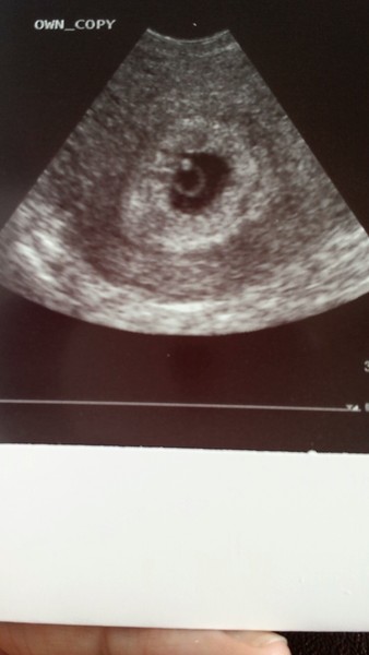 Not so new and not so expert!