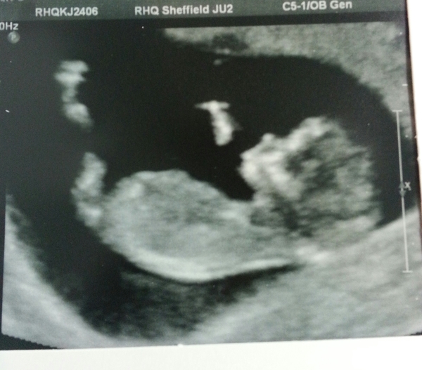 Just Shagging Grads Thread 9 - Roll Up, Roll Up all you graduated Viroids!