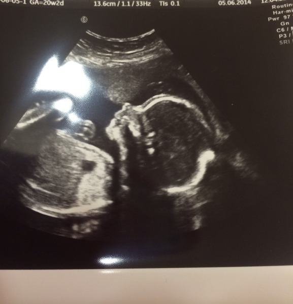 October 2014 - thread 7: blooming or just blooming hot?