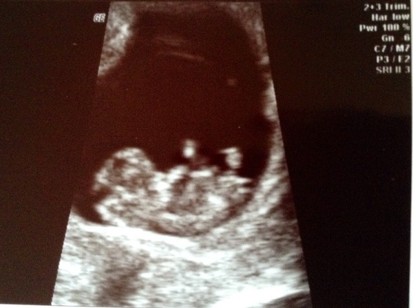 First appointments and scans here we come, jan 2015 thread #3
