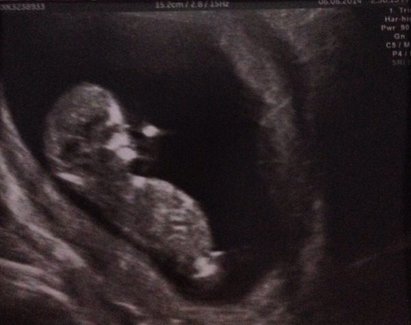 We have fire in our bellies, we're incubating our little Penis Dragons! #3