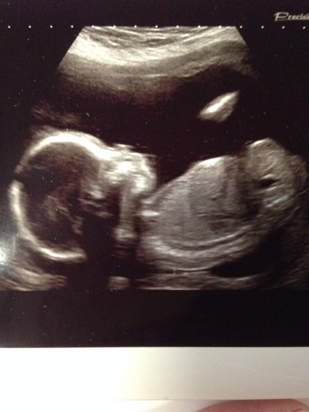 Just Shagging Grads Thread 9 - Roll Up, Roll Up all you graduated Viroids!