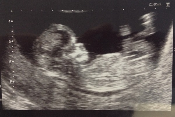 We have fire in our bellies, we're incubating our little Penis Dragons! #3