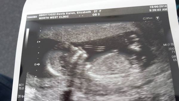 December 2014 Thread #4