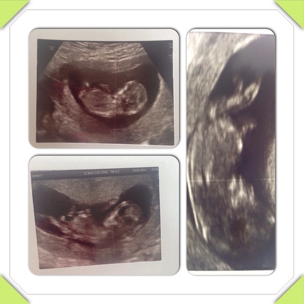 The 'Umm newbie'/ 'Thread maxed out' lovely ladies!