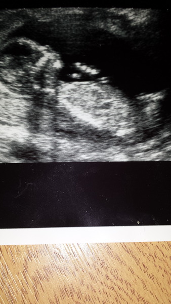 guess the gender?!