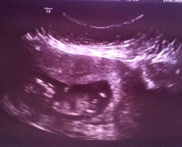 December 2014 Thread #4