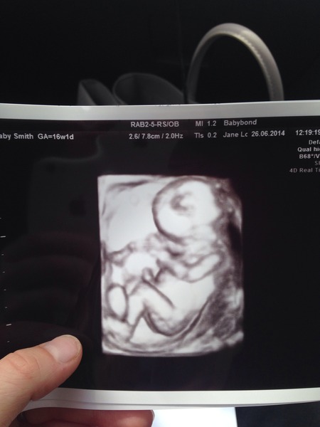 Pregnant after MC due December 14