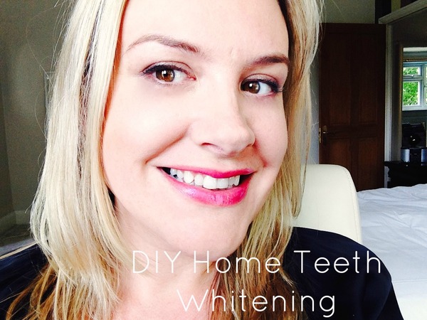 Best Teeth Whitening products you can recommend