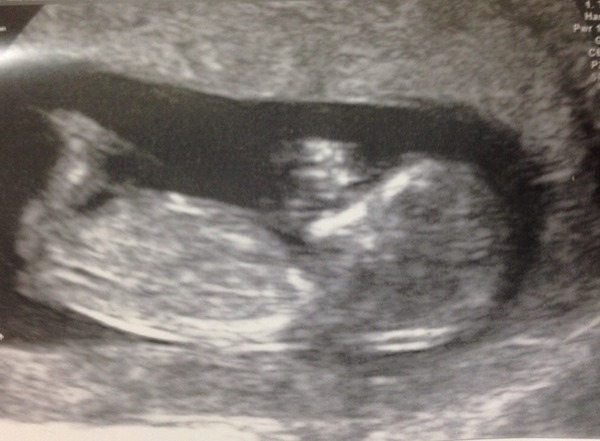 Just Shagging Grads Thread 9 - Roll Up, Roll Up all you graduated Viroids!