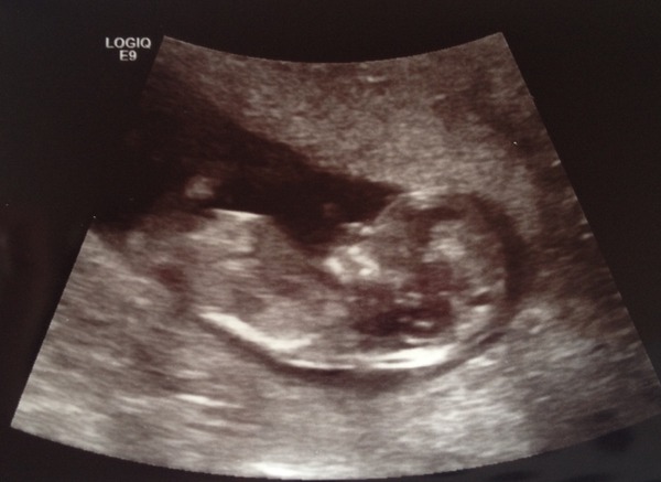 12 week scan pic - can anyone guess the sex?
