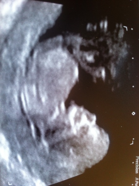 December 2014 Thread #4