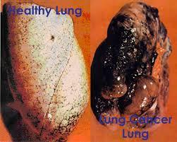 Smoking