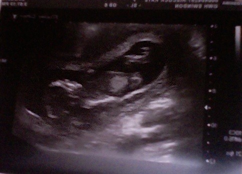 Leaving the first trimester behind and hopefully all the sickness and worry that has come with it. January 2015 thread #5