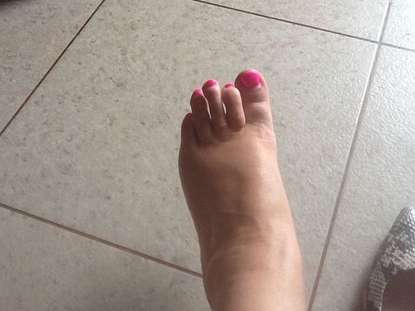 Toenail varnish
