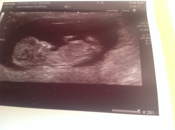 We have fire in our bellies, we're incubating our little Penis Dragons! #4