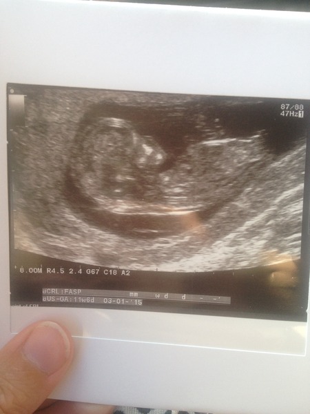 Morning sickness go away but don't come again another day.... Let's start glowing for all the right reasons! Jan 2015 thread 4...