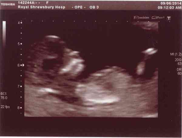 December 2014 Thread #4