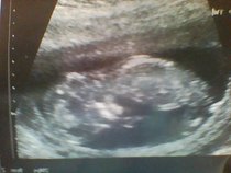 Leaving the first trimester behind and hopefully all the sickness and worry that has come with it. January 2015 thread #5