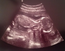 December 2014 Thread #4