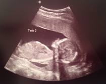 December 2014 Thread #4