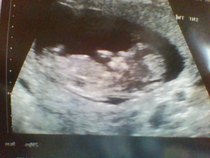 Leaving the first trimester behind and hopefully all the sickness and worry that has come with it. January 2015 thread #5