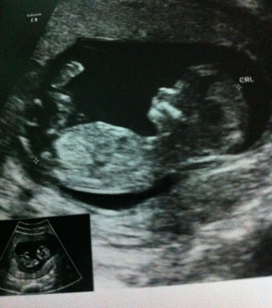 Gender guesses please!