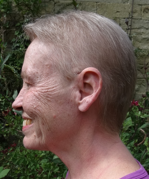 Zombie's  journey with breast cancer