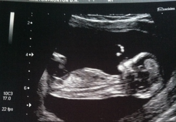Boy or Girl?! Photo..