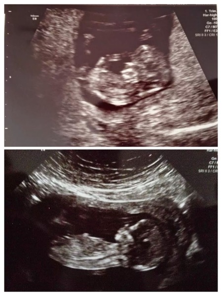 The 'Umm newbie'/ 'Thread maxed out' lovely ladies!