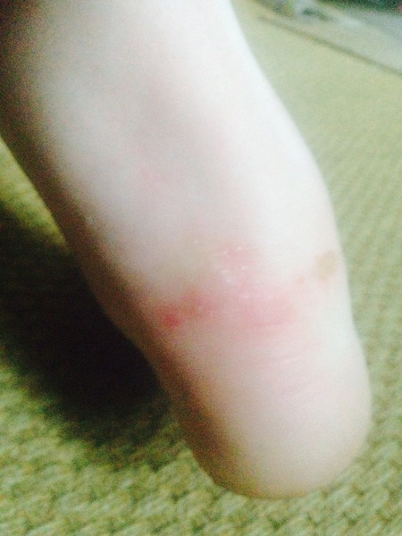 Wtf is wrong with my foot?