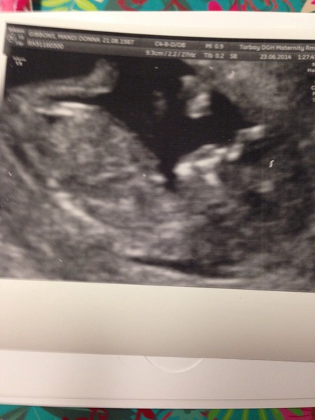 Leaving the first trimester behind and hopefully all the sickness and worry that has come with it. January 2015 thread #5