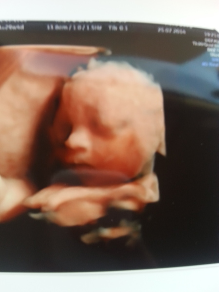 October 2014 #9 - Into the home straight we go, 3rd trimester here we come!