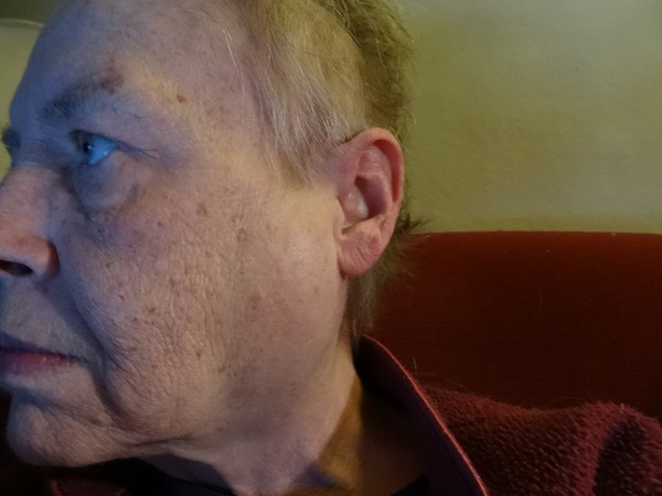 Travels with Zombie - Chemo Cycle 2 and beyond