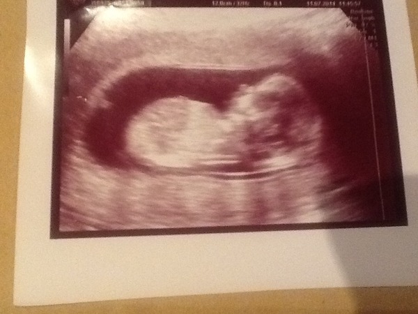 Trying to guess gender, but not sure if there is even a nub!!