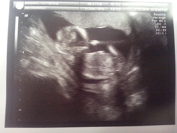 Leaving the first trimester behind and hopefully all the sickness and worry that has come with it. January 2015 thread #5