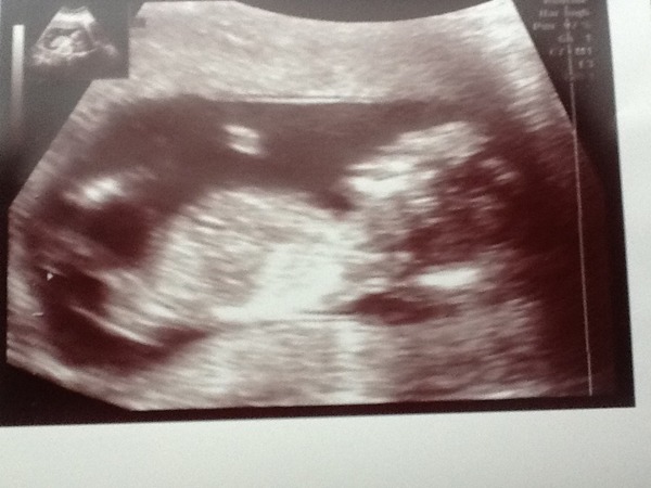 Trying to guess gender, but not sure if there is even a nub!!