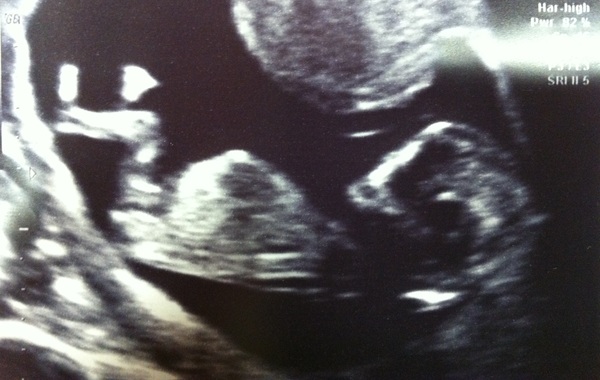 What's this on my scan?