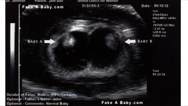 Do scans have the fathers name on?