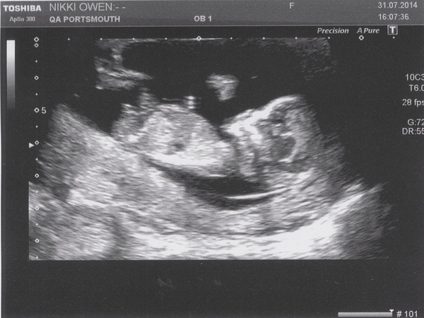 It's all balls, bicycles, and babies for the PESH!