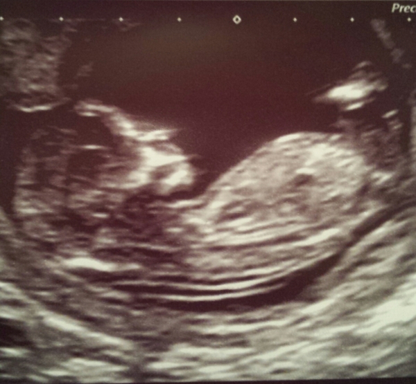 February 2015 #2: Is the first trimester over yet?