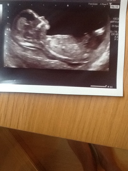 Not so new and not so expert!