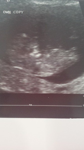 Not so new and not so expert!